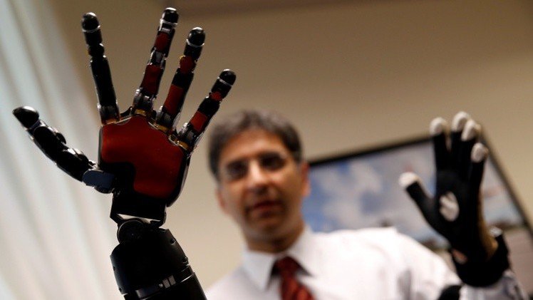 Video: Controla sus brazos con la mente  después de pasar 40 años amputado