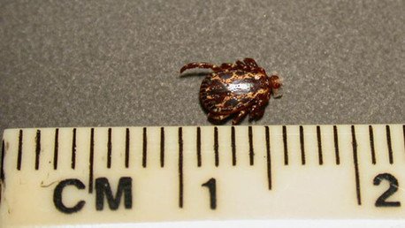 Un virus de origen desconocido mata a la primera víctima en EE.UU.