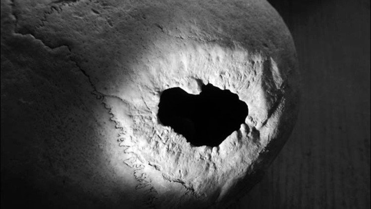 Revelan cómo era la cirugía cerebral practicada en Siberia hace 2.300 años