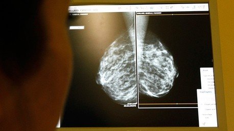 El cáncer, ¿una cuestión de 'mala suerte'?: Concluyen que la mayoría surgen por azar