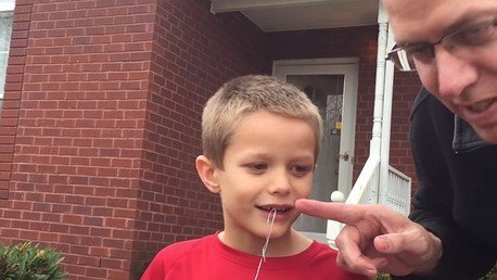 Un padre le saca una muela a su hijo con la ayuda un palo de golf