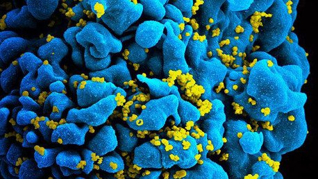 La razón de por qué no hay una vacuna contra el sida