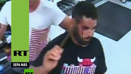 Nunca perdió la calma: pide ayuda con una barra de metal clavada en la cabeza