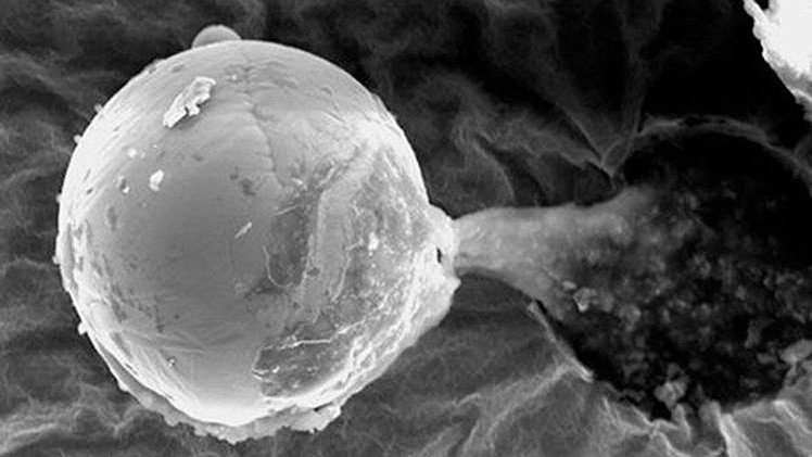 Hallan una extraña bolita de metal que podría ser una 'semilla' alienígena