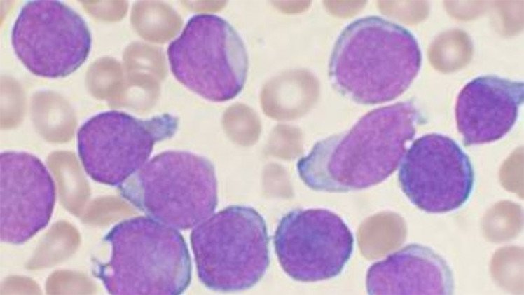 ¿La panacea contra el cáncer? Científicos afirman que la leucemia puede devorarse