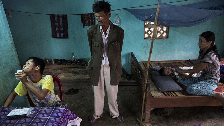 40 años después, el Agente Naranja sigue causando estragos en Vietnam