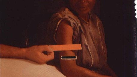 Guatemaltecos demandan a corporaciones de EE.UU. por infección masiva con sífilis 