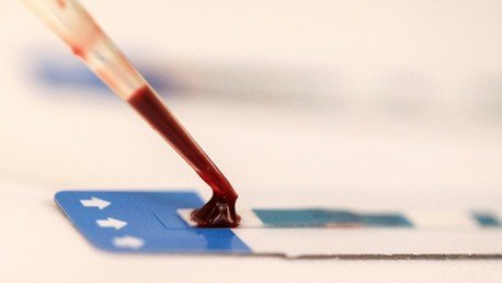 Científicos encuentran una manera de matar el VIH, abriéndolo "como una flor"