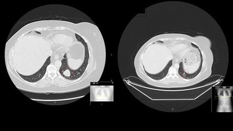 Presentan un revolucionario tratamiento biotecnológico contra varios tipos de cáncer