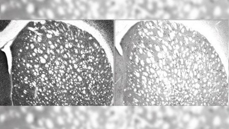 Científicos revelan qué ayuda a adaptarse a los cambios de la vida