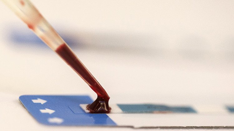 ¿Existe ya la cura del sida? Una adolescente francesa vence el VIH tras dejar el tratamiento