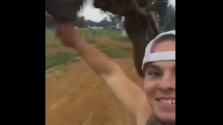 Hace un selfi y termina en el hospital: hay que pensárselo dos veces antes de encender la cámara