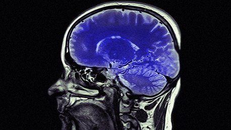 Una técnica de estimulación cerebral no invasiva podría revolucionar el tratamiento del dolor