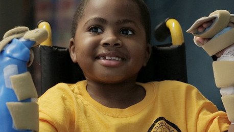 Trasplantan ambas manos a un niño por primera vez en el mundo