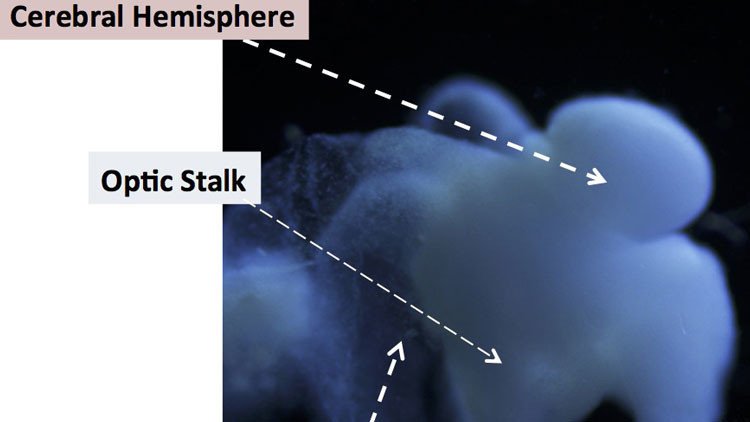 Avance revolucionario: cultivan un cerebro humano en un laboratorio