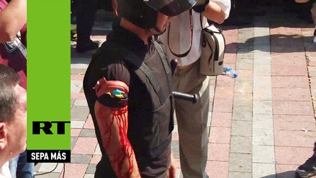 PRIMERAS IMÁGENES: Una granada explota en el exterior del Parlamento ucraniano en Kiev 