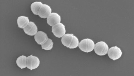 Alerta por el aumento de casos de una enfermedad ‘carnívora' en Japón