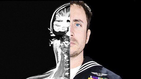 El Pentágono implanta 'chips de memoria' en los cerebros de 24 voluntarios