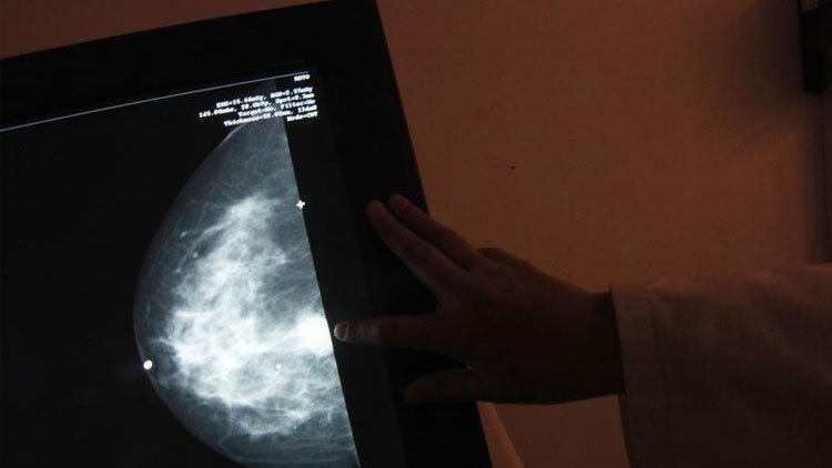 No solo la carne procesada causa cáncer: OMS anuncia 116 elementos que pueden provocar la enfermedad