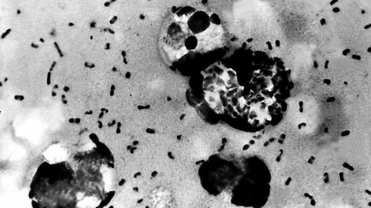 Estados Unidos confirma un nuevo caso de peste bubónica