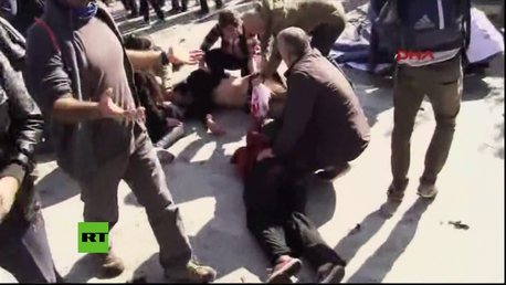 PRIMERAS IMÁGENES: Dos fuertes explosiones se cobran decenas de vidas en Turquía