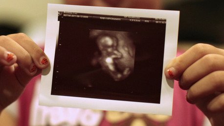 Quimera humana: un gemelo no nacido se convierte en el 'padre' de su sobrino