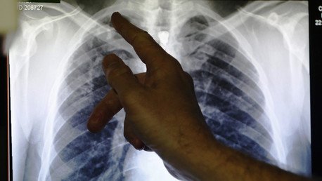 La OMS revela qué enfermedad se cobra más vidas que el sida