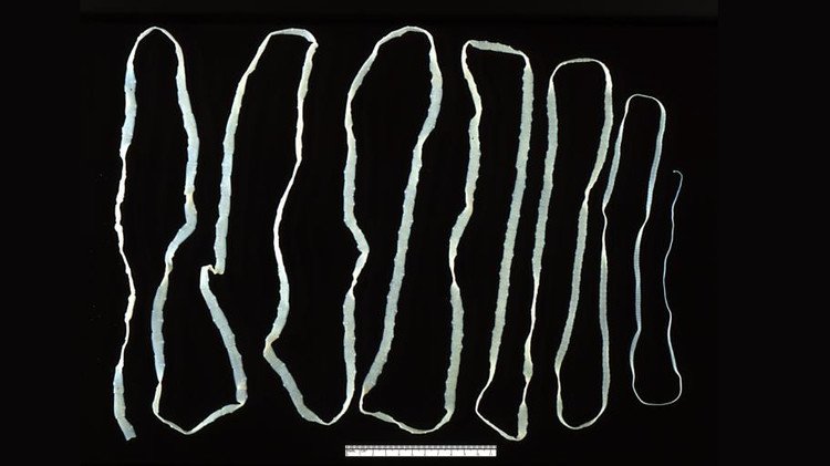 Sin precedentes: un colombiano muere tras contraer un cáncer "no humano"