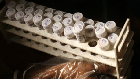 Cóctel mortal: los contagios del VIH se disparan antes de las guerras