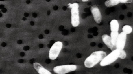 "Es casi demasiado tarde para evitar que haya una superbacteria resistente a los antibióticos"