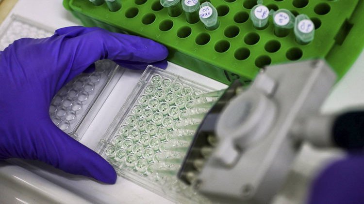 Afortunada coincidencia: tratamiento para el cáncer podría ser la clave contra el alzhéimer