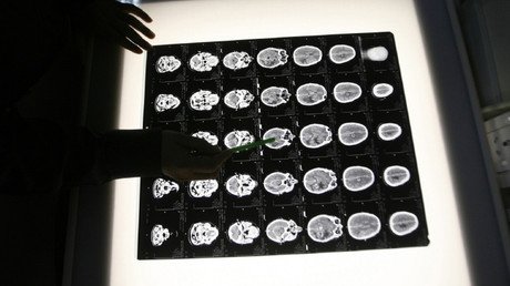 Un modelo matemático predice el desarrollo de los tumores cancerosos