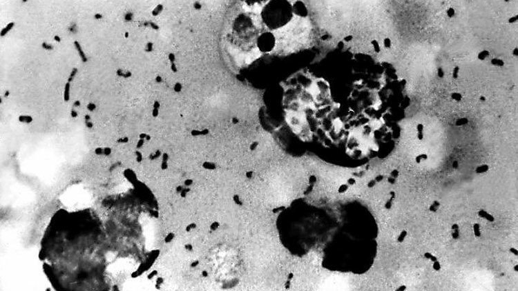 La peste en Europa: Una muerte negra latente que podría despertar