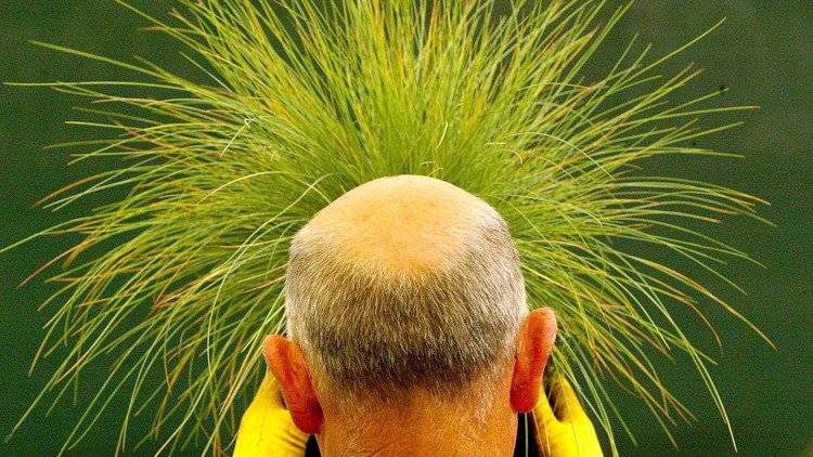 Descubren la razón que se oculta detrás de la calvicie