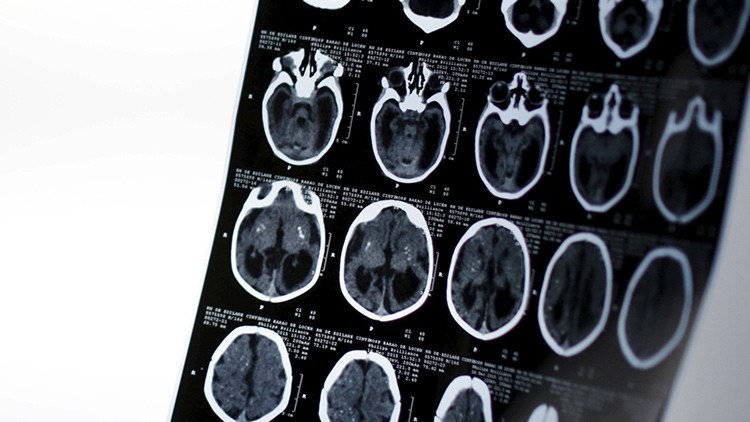 ¿Cómo destruimos nuestro cerebro a diario sin saberlo?