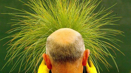 Descubren la razón que se oculta detrás de la calvicie