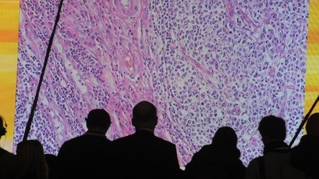 Cuba no escatima esfuerzos para avanzar en el tratamiento del cáncer