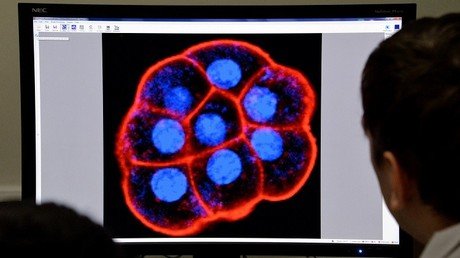 Cerebro bajo LSD: así son las primeras imágenes que muestran los cambios tras consumir la droga