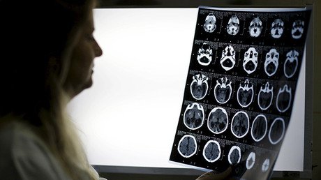 Сomer cerebros humanos protegió a una tribu de las enfermedades cerebrales