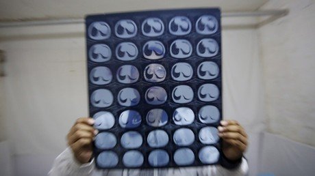 Crean un medicamento que "atasca" las células cancerosas