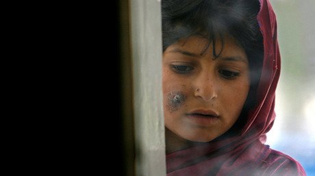 Una enfermedad preocupante se extiende desde Siria por Oriente Medio y ha llegado a Europa