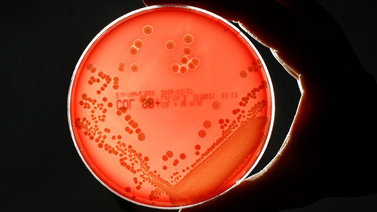 Hallan una insólita causa de enfermedades humanas