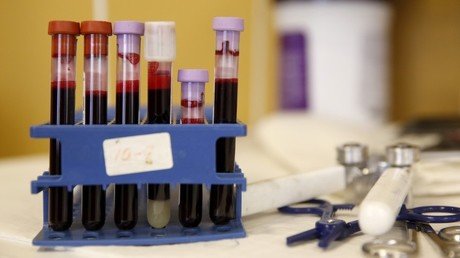 Crean una prueba de sangre que predice un ataque al corazón con 5 años de antelación