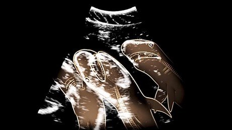 La impresionante ecografía de una hembra de tiburón embarazada