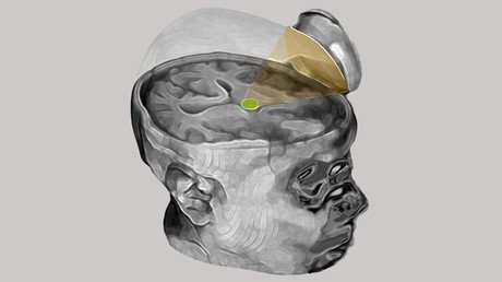 'Resucitó' en 3 días: un paciente sale del coma con un novedoso procedimiento de ultrasonido