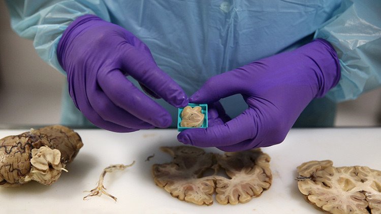 Podrías tener estas partículas en el cerebro por respirar el aire de Ciudad de México