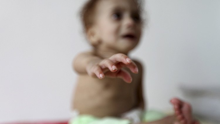 Espeluznantes imágenes de niños famélicos nos muestran la crueldad de una guerra olvidada