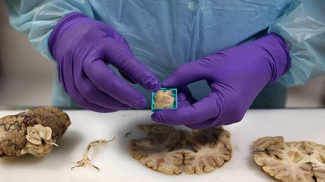 Podrías tener estas partículas en el cerebro por respirar el aire de Ciudad de México