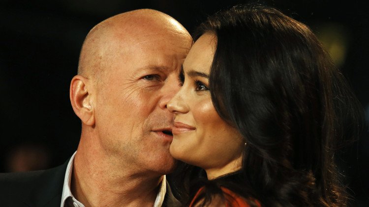 ¿Más atractivos y sanos?: La calvicie aporta inesperados beneficios