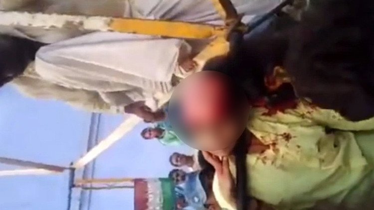 Una chica pierde su cuero cabelludo al hacerse un selfi junto a una noria